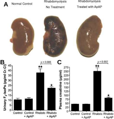 The role of circulating cell-free hemoglobin in sepsis-associated acute