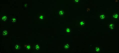 ANCA Formalin Fluorescent Test System – Immuno Concepts