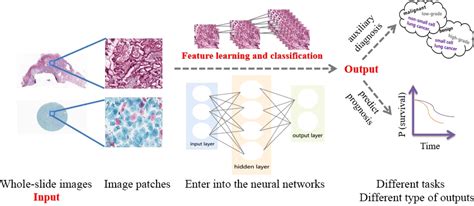 Emerging Role Of Deep Learning‐based Artificial Intelligence In Tumor