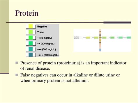 Ppt Examination Of Urine Powerpoint Presentation Id497429