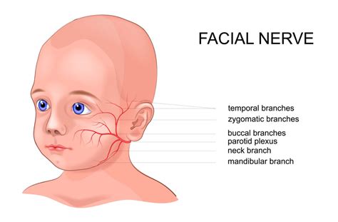 Facial Nerve Palsy Treatment