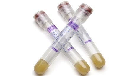 BD Vacutainer PPT Venous Blood Collection Tube Medentrx