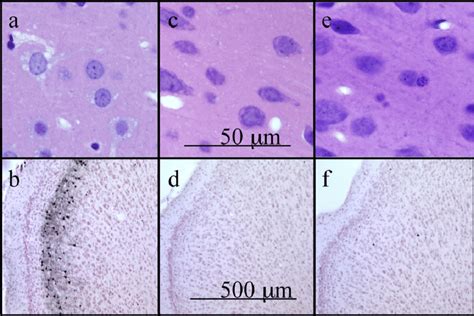 Representative histological sections of the retrosplenial cortex from ...