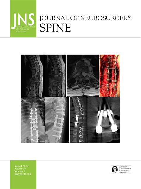 Neurosurgery Spine