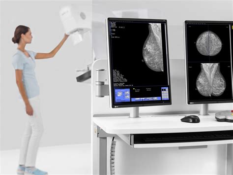 Mamograf MAMMOMAT Fusion Siemens Supermedical