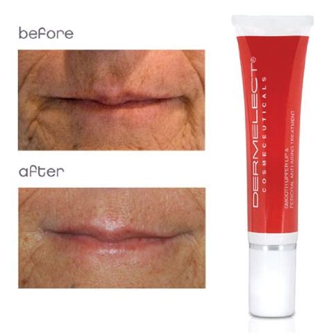 Top 5 Best Wrinkles Upper Lip For Sale 2017 Product Md News Daily