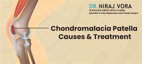 Chondromalacia Patella Causes And Treatment