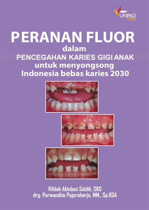 Peranan Fluor Dalam Pencegahan Karies Gigi Anak Untuk Menyongsong