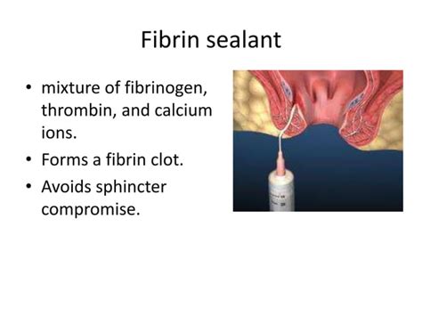 Fistula | PPT