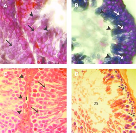 Cross Section From The Testes A Control Group Note Spermatogenesis