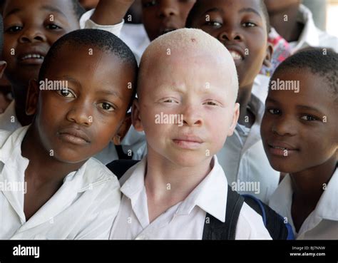 Sudáfrica Albino muchacho negro con alumnos de un colegio de