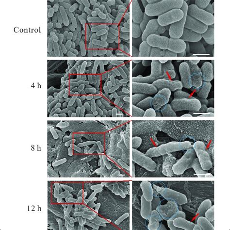 | TEM micrograph showing the four changing stages of mesosome-like... | Download Scientific Diagram