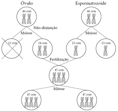 O Que Causa A Trissomia Educar Sa De