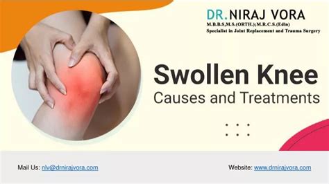 Ppt Swollen Knee Causes And Treatment Dr Niraj Vora Powerpoint Presentation Id 12683195