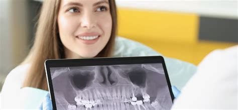 Dental X-Rays | San Ramon, CA | Pro Smile Dental Care