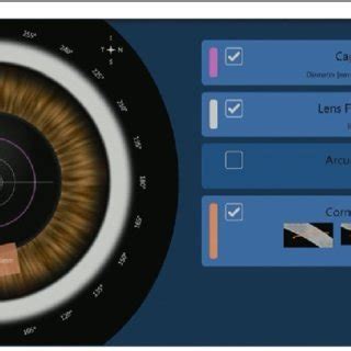 Femtosecond Laser Treatment Planning For Capsulotomy Lens