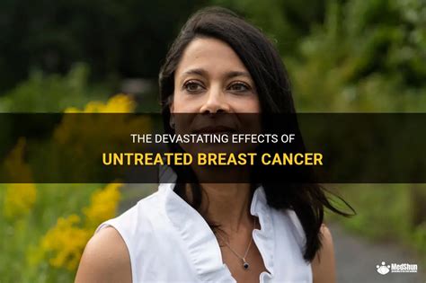 The Devastating Effects Of Untreated Breast Cancer Medshun