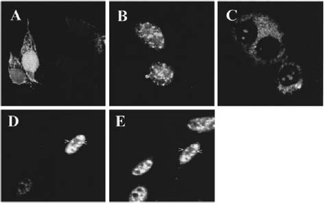 Cellular Localization Of The Complete And Truncated Forms Of The Orf 57