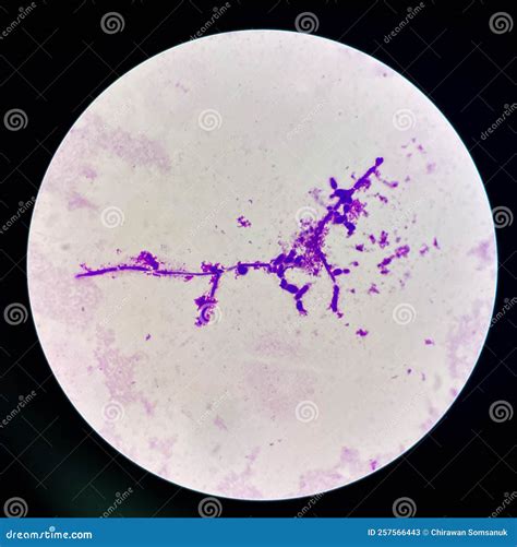 Budding Yeast Cells With Pseudohyphae In Urine Sample On Wright Gimsa