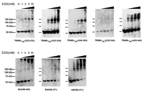 Comparative Requirements For The Restriction Of Retrovirus Infection By