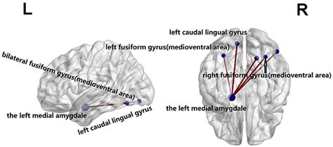 Frontiers Altered Functional Brain Connectomes Between Sporadic And