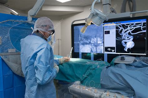 Interventional Neuroradiology Stock Image C038 0176 Science Photo