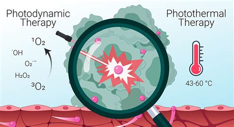 Photodynamic And Photothermal Therapies Synergy Opportunities For