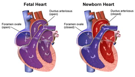 Class 3 Peds Perfusion And Gas Exchange Flashcards Quizlet