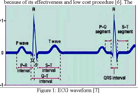 Figure 1 from Morphological changes in congestive heart failure ECG ...