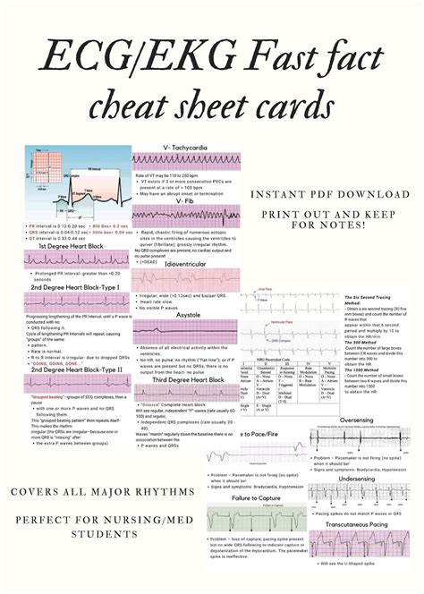 ECG/EKG Fast Fact Cheat Sheet Card - Etsy