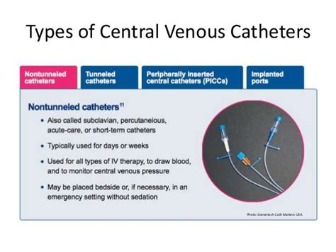 Types Of Venous Access Devices