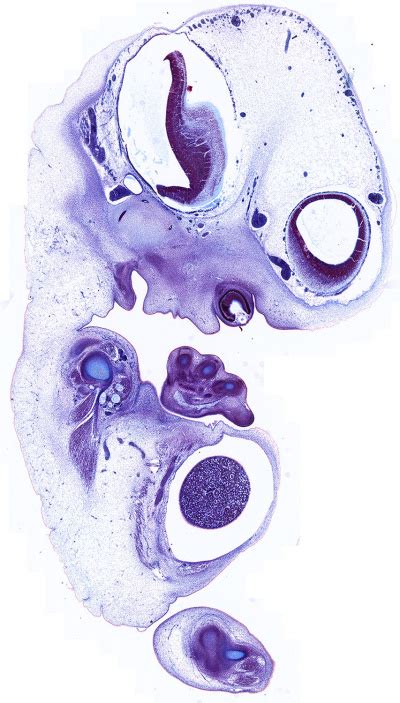 Carnegie Stage 18 Embryology Nursery Drawings Figure Painting Art