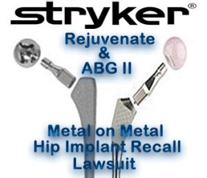 Stryker Hip Lawsuit - Stephens Fiddes McGill and Associates, P.C.