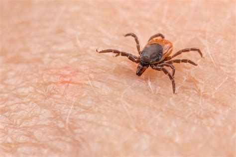 Lyme Disease Tick Bite Pictures