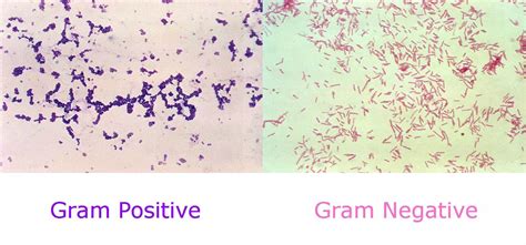 6 Gram Staining And Infection Investigations SimpleMed Learning