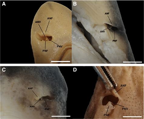 Illustration Of Anterior And Posterior Nasal Valve S In A M Canis