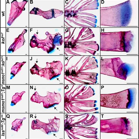 Loss Of Msmo And Lss Activity Is Associated With Abnormal Endochondral