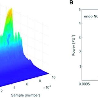 A Three Dimensional Wavelet Transform WT Of The Laser Doppler LD