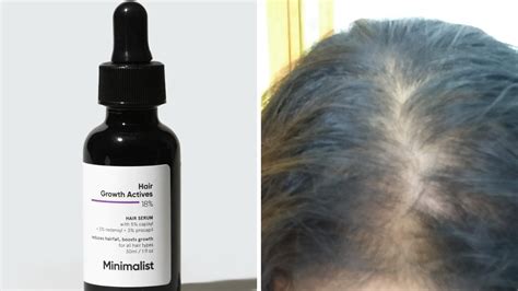 HONEST Minimalist Hair Growth Actives Minimalist Hair Growth