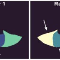 Left to right: axial MRI of paraspinal muscles, along with the majority ...