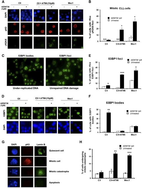 Atr Inhibition Results In Accumulation Of Dna Damage And Mitotic