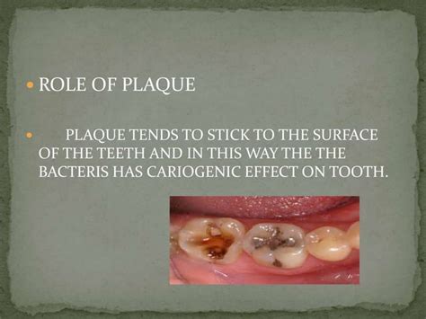 Microbiology Of Dental Caries Ppt