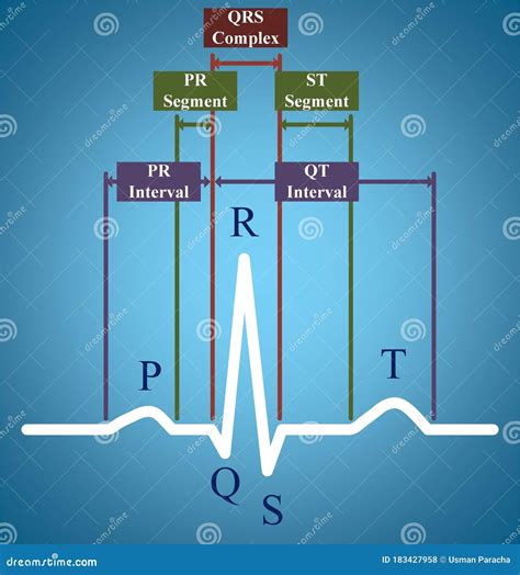 Ecg Of Elektrocardiogram Met Qrs Complex Stock Illustratie