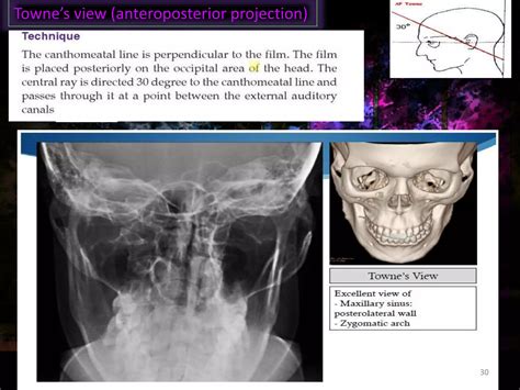 conventional radiography in maxillofacial trauma | PPTX