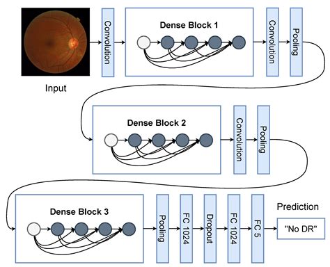 Applied Sciences Free Full Text Diabetic Retinopathy Improved