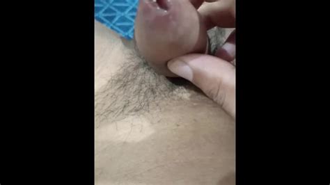 Applyime Medicine My Syphilis Sexual Transmitted Disease Penis Getting More Swallon On My Dick He