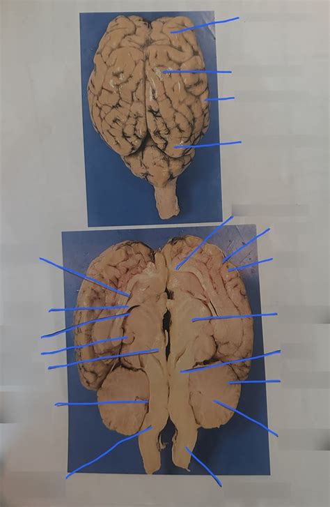 Sheep Brain Labeled Diagram Quizlet