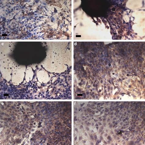 Sem Micrographs Of Osteoblast Like Cells Cultured On Silane Modified