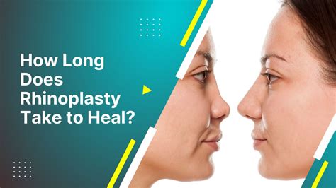 Healing Stages Of Rhinoplasty How Long Does Rhinoplasty Take To Heal