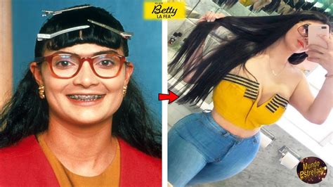 Asi Lucen Los Actores De Yo Soy Betty La Fea En Antes Y